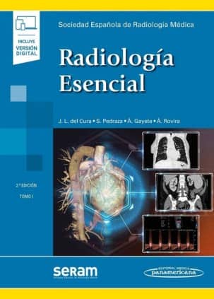 SERAM:RADIOLOGIA ESENCIAL  2ED, 2T+E