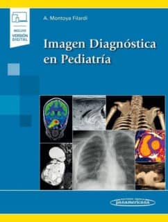 MONTOYA:IMAGEN DIAGNOSTICA PEDIATRIA+E