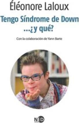 TENGO SINDROME DE DOWN Y QUE