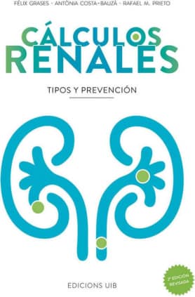 Cálculos renales