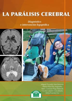 LA PARALISIS CEREBRAL