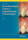 LINDHE:PERIODONTOLOGIA CLINICA 6A ED. T2
