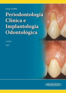 LINDHE:PERIODONTOLOGIA CLINICA 6A ED. T2