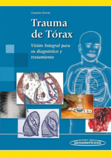 CASALLAS:TRAUMA DE TORAX
