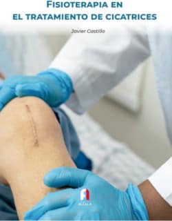 FISIOTERAPIA EN EL TRATAMIENTO DE CICATRICES