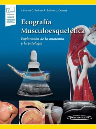 IRIARTE:ECOGRAFIA MUSCULOESQUELETICA +E