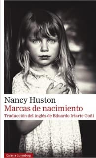 Marcas de nacimiento