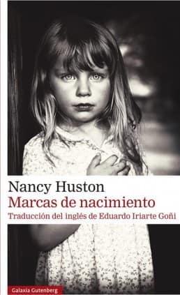 Marcas de nacimiento