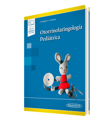 Otorrinolaringología Pediátrica