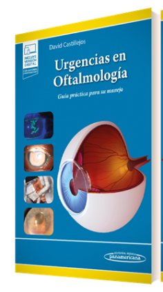 Urgencias en oftalmología