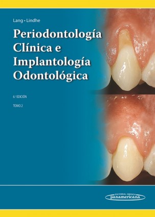 LINDHE:PERIODONTOLOGIA CLINICA 6A ED. T2
