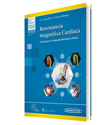 Resonancia Magnética Cardíaca (+ebook)