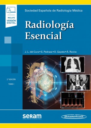 SERAM:RADIOLOGIA ESENCIAL  2ED, 2T+E