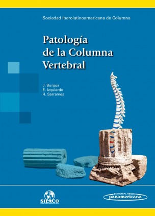 SILACO:PATOLOGIA DE LA COLUMNA VERTEBRAL