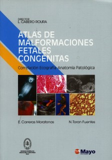 Atlas de malformaciónes fetales congénitas