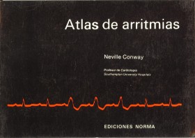 Atlas de arritmias