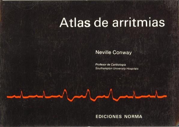 Atlas de arritmias