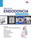 Manual de endodoncia. La guía definitiva