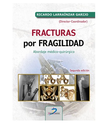 FRACTURAS POR FRAGILIDAD