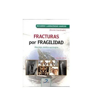 FRACTURAS POR FRAGILIDAD
