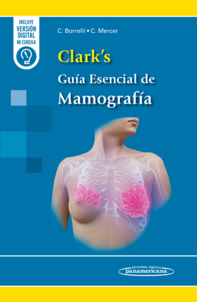 Clark's Guía Esencial de Mamografía