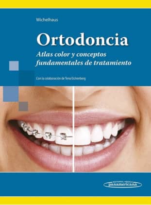 WICHELHAUS:ORTODONCIA ATLAS