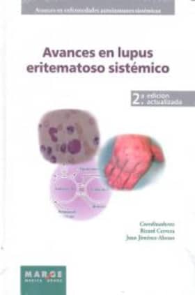 Avances en lupus eritematoso sistémico