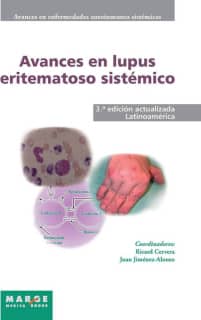 Avances en lupus eritematoso sistémico - Latinoamérica