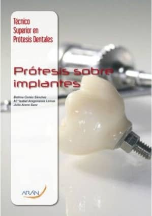 Prótesis sobre implantes