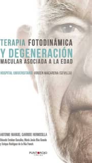 TERAPIA FOTODINAMICA Y DEGENERACION MACU