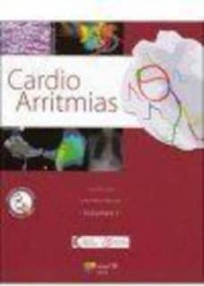 Cardio Arritmias