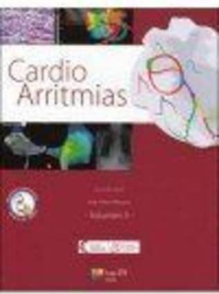Cardio Arritmias