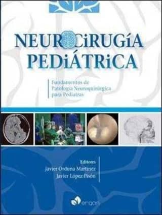NEUROCIRUGIA PEDIATRICA. FUNDAMENTOS DE