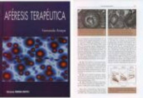 Aféresis terapeutica