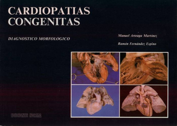 Cardiopatias congenitas