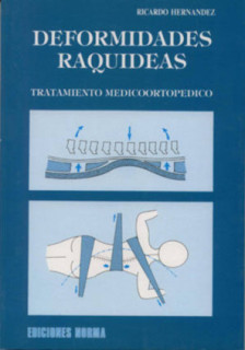 Deformidades raquideas