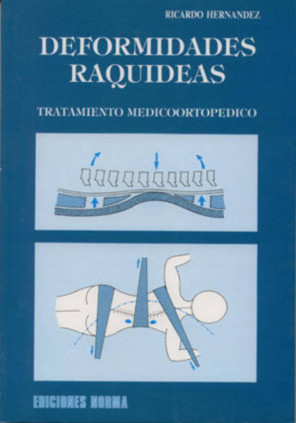Deformidades raquideas