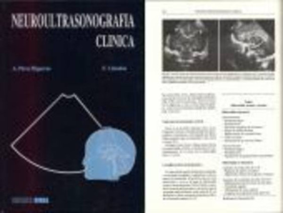 Neuroultrasonografia clinica