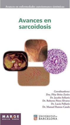 Avances en sarcoidosis